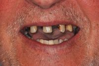 Smile In A Day 4 before